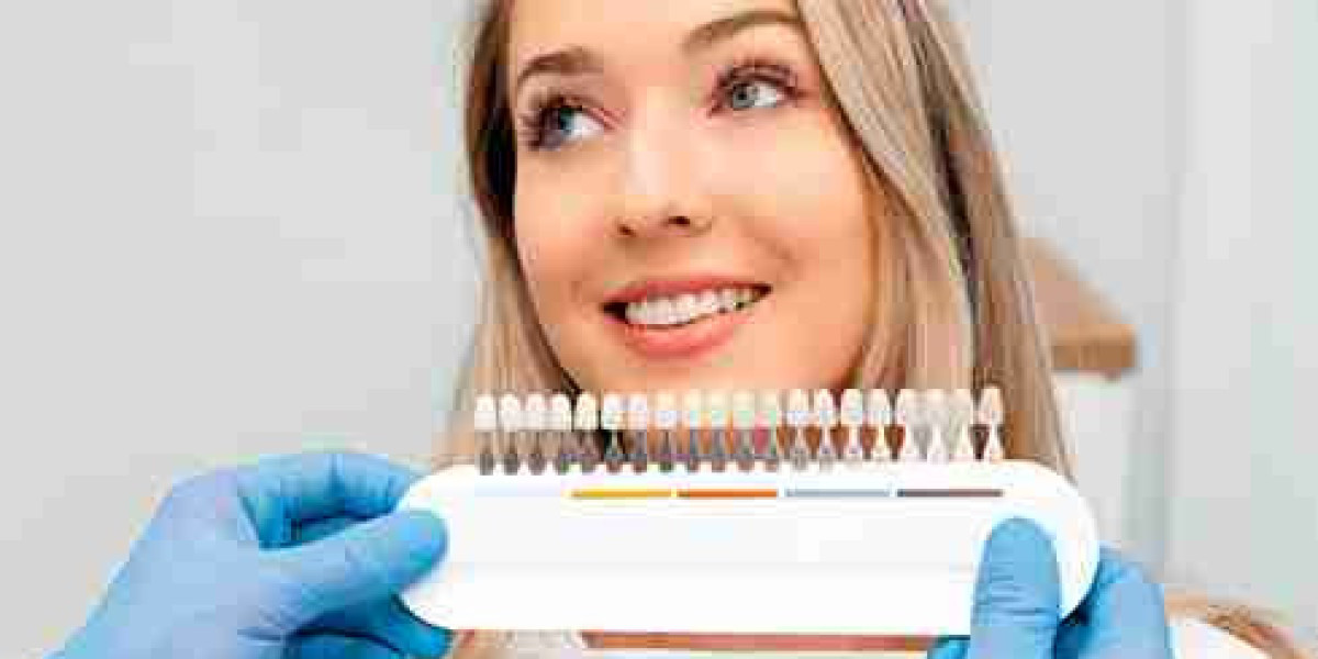 Solutions That Go Beyond Dentures in Dartford