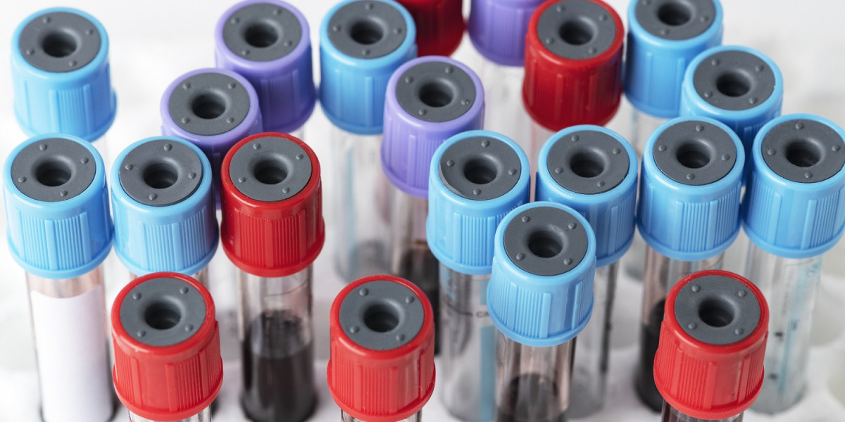 Autoimmune Disease ELISA Kits