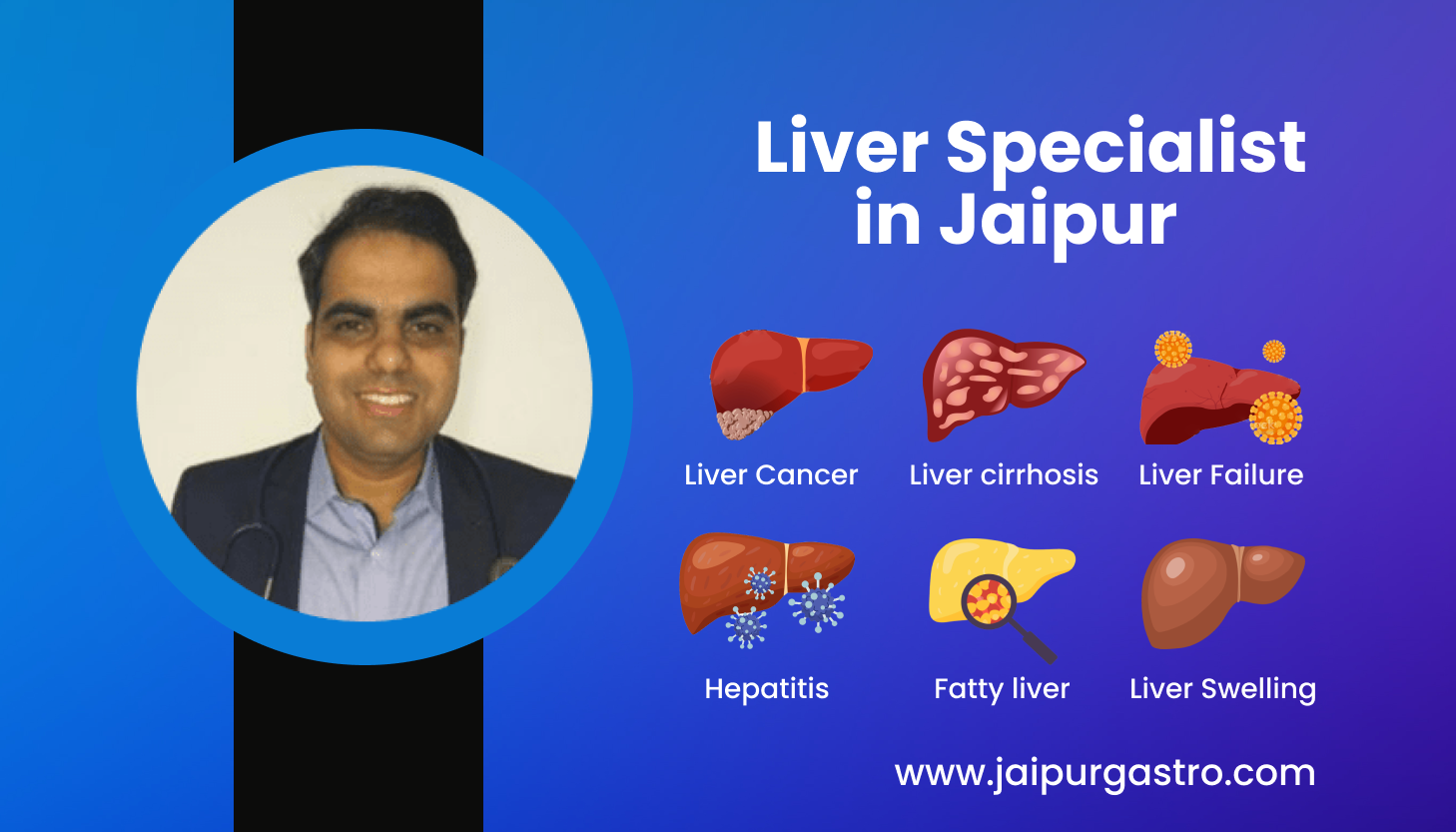 Best Liver Specialist Doctor in Jaipur - Dr. Shankar Dhaka
