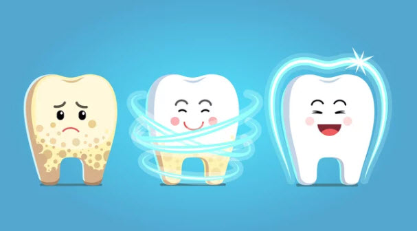 Deep Teeth Cleaning vs Regular Scaling in Singapore - Writeology X