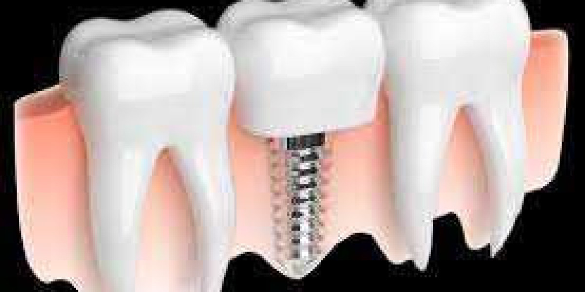   laser gum surgery near me