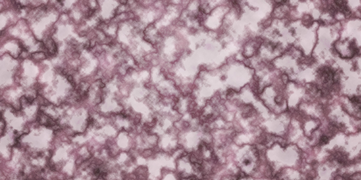 Understanding 0 Credit Check Loans: A Financial Lifeline or A Risky Gamble?