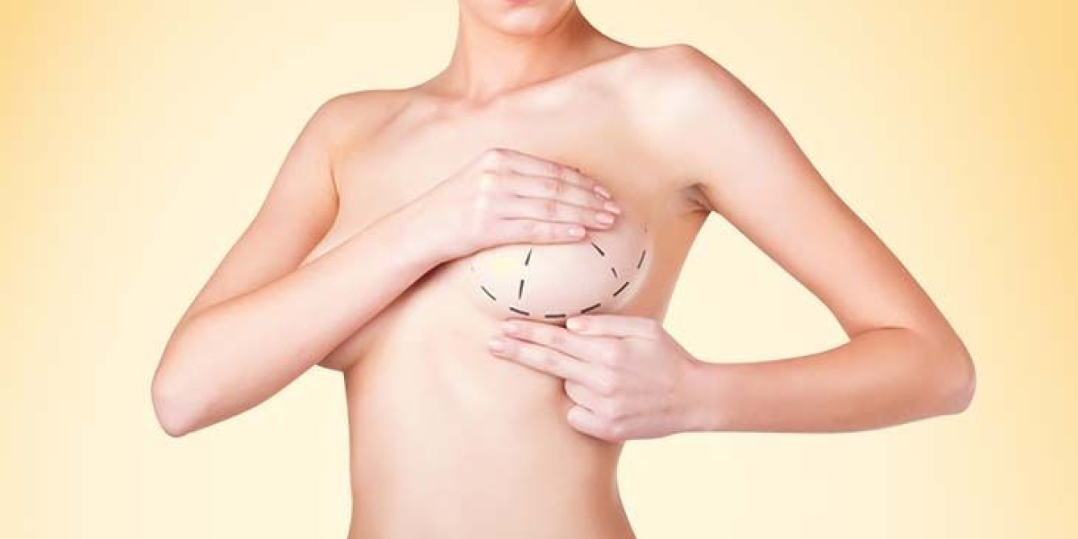 Breast Augmentation Surgery in Dubai – Cost, Procedure & Expert Care by Dr. Anshu