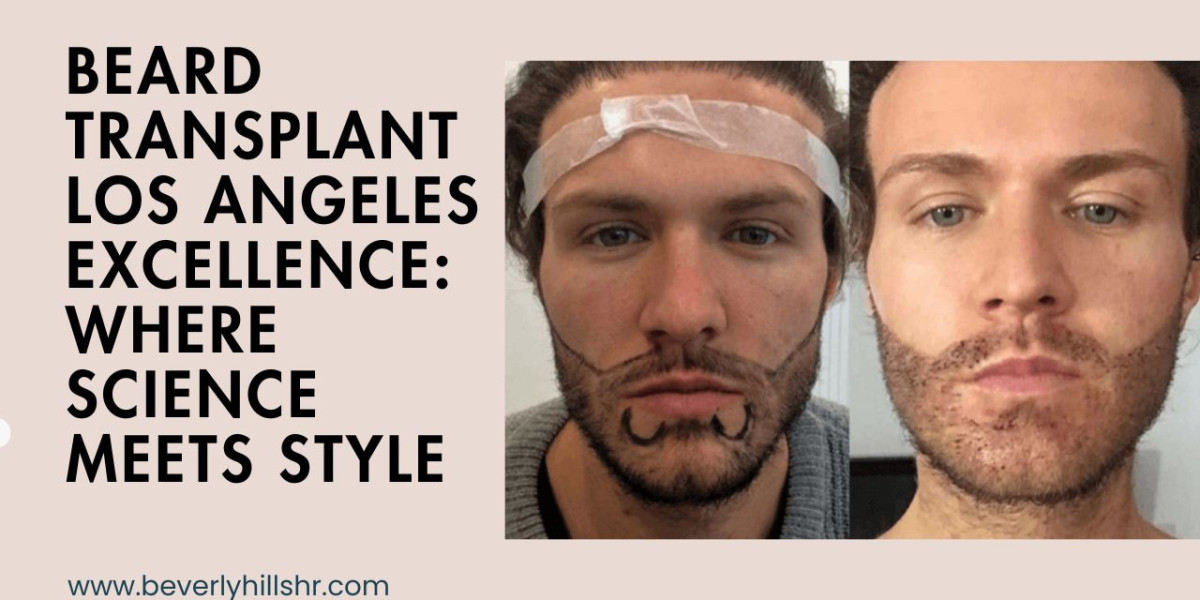 Beard Transplant Los Angeles Excellence: Where Science Meets Style