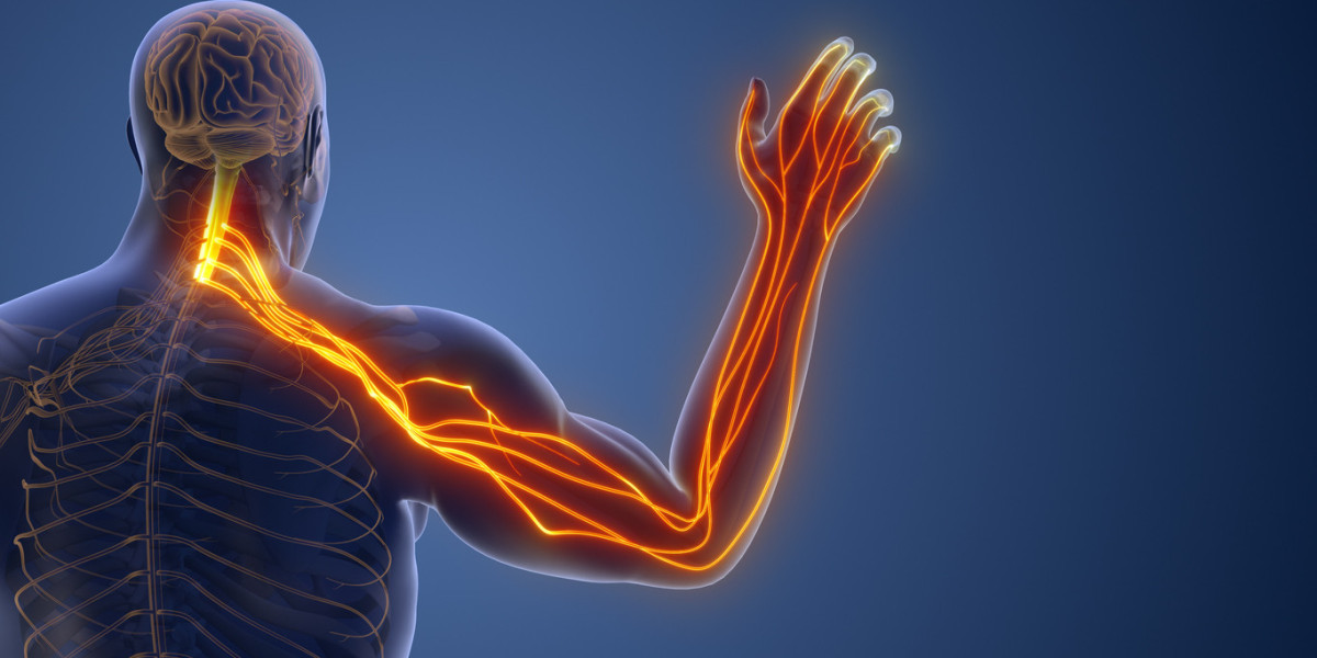 Cervical Radiculopathy- When Neck Nerve Pain Becomes a Daily Problem