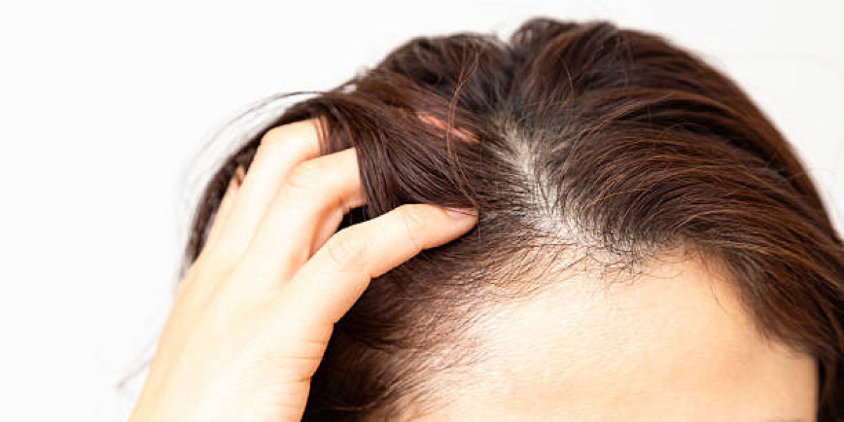 How Does Exosome Therapy Compare to Hair Transplant?